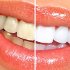 Как самостоятельно отбелить зубы